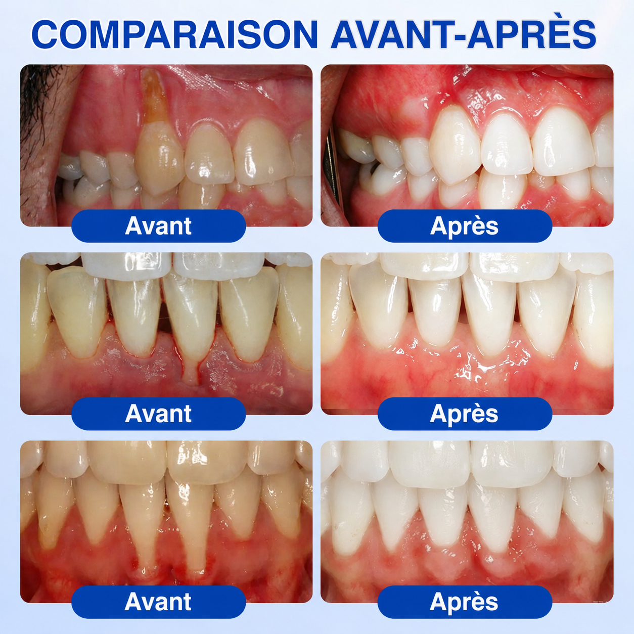 🎗️🛩️ 𝑮𝒍𝒊𝒎𝒎𝒆𝒓𝒍𝒚® 𝑮𝒖𝒎𝑹𝒆𝒗𝒊𝒗𝒆 𝑮𝒆𝒍 𝒅𝒆 𝑹é𝒑𝒂𝒓𝒂𝒕𝒊𝒐𝒏 𝑷𝒂𝒓𝒐𝒅𝒐𝒏𝒕𝒂𝒍𝒆.