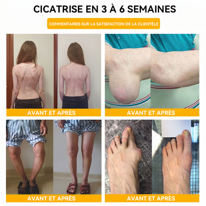 𝐍𝐞𝐤𝐢𝐬𝐬® 𝐂𝐫è𝐦𝐞 𝐝𝐞 𝐬𝐨𝐮𝐥𝐚𝐠𝐞𝐦𝐞𝐧𝐭 𝐝𝐞 𝐥𝐚 𝐝𝐨𝐮𝐥𝐞𝐮𝐫 𝐞𝐭 𝐝𝐞 𝐠𝐮é𝐫𝐢𝐬𝐨𝐧 𝐨𝐬𝐬𝐞𝐮𝐬𝐞 𝐚𝐮 𝐯𝐞𝐧𝐢𝐧 𝐝'𝐚𝐛𝐞𝐢𝐥𝐥𝐞 🚀🚀 (𝐂𝐨𝐧ç𝐮𝐞 𝐬𝐩é𝐜𝐢𝐚𝐥𝐞𝐦𝐞𝐧𝐭 𝐩𝐨𝐮𝐫 𝐥𝐞𝐬 𝐚î𝐧é𝐬)