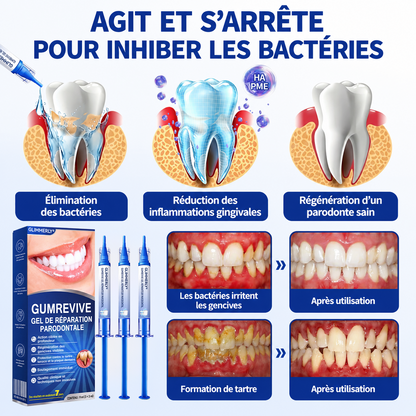 🎗️🛩️ 𝑮𝒍𝒊𝒎𝒎𝒆𝒓𝒍𝒚® 𝑮𝒖𝒎𝑹𝒆𝒗𝒊𝒗𝒆 𝑮𝒆𝒍 𝒅𝒆 𝑹é𝒑𝒂𝒓𝒂𝒕𝒊𝒐𝒏 𝑷𝒂𝒓𝒐𝒅𝒐𝒏𝒕𝒂𝒍𝒆.
